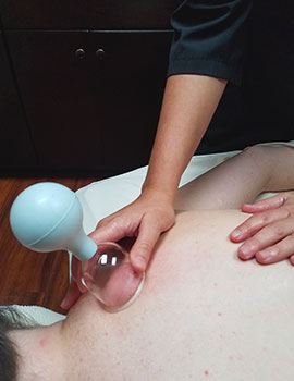 Picture of Massage Therapist administering Cupping Massage to Client